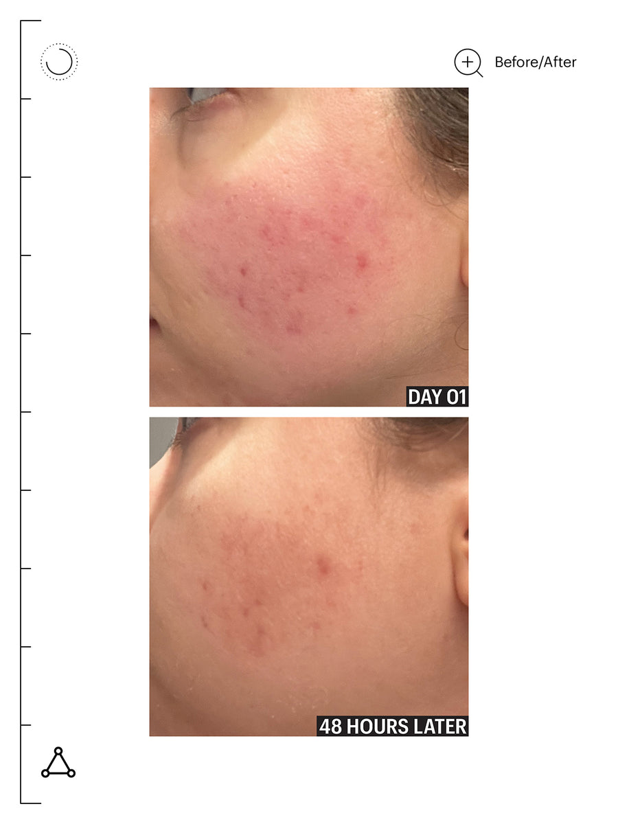 Molecular Barrier Recovery Cream Balm
