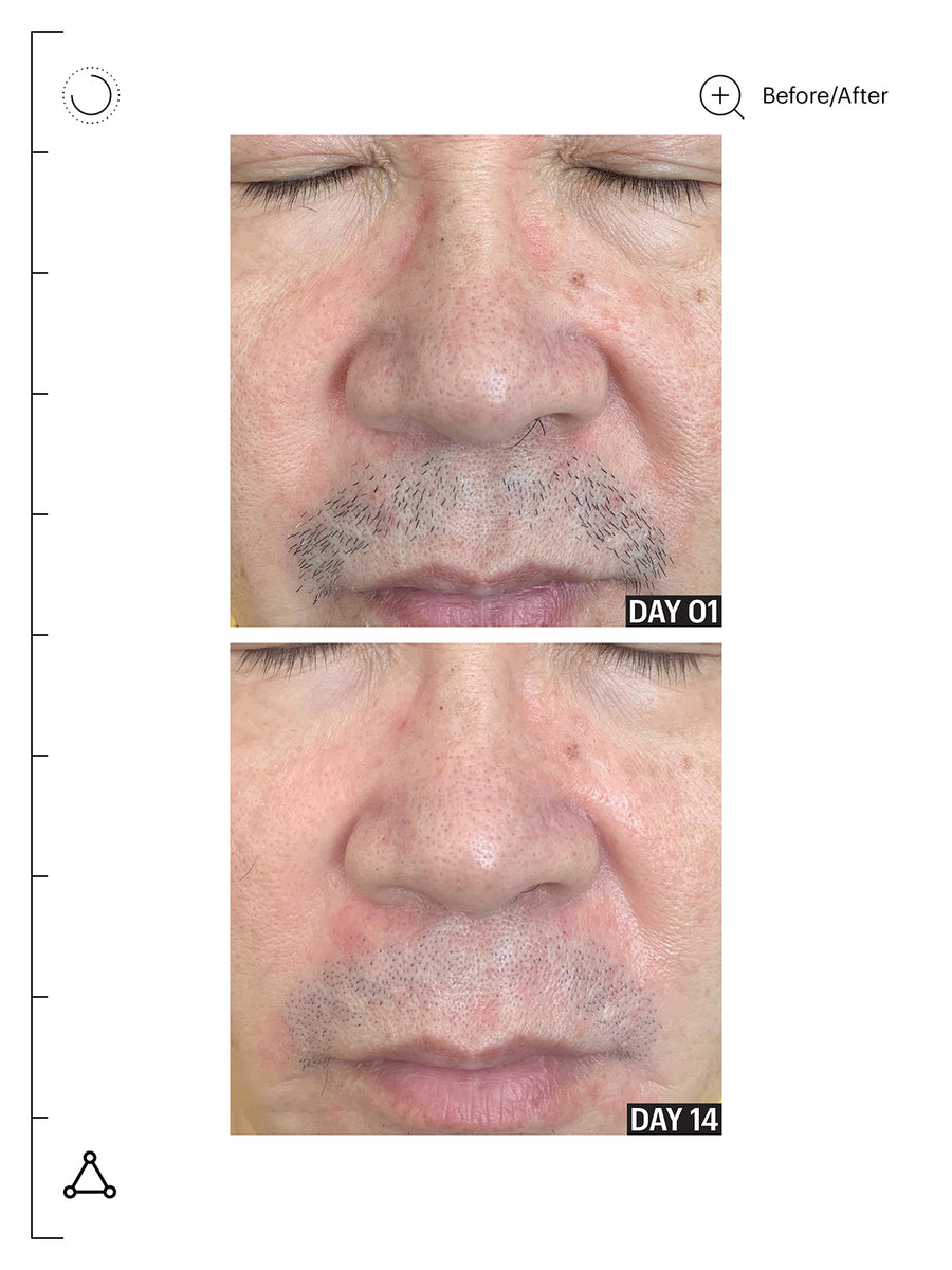 Molecular Barrier Recovery Cream Balm