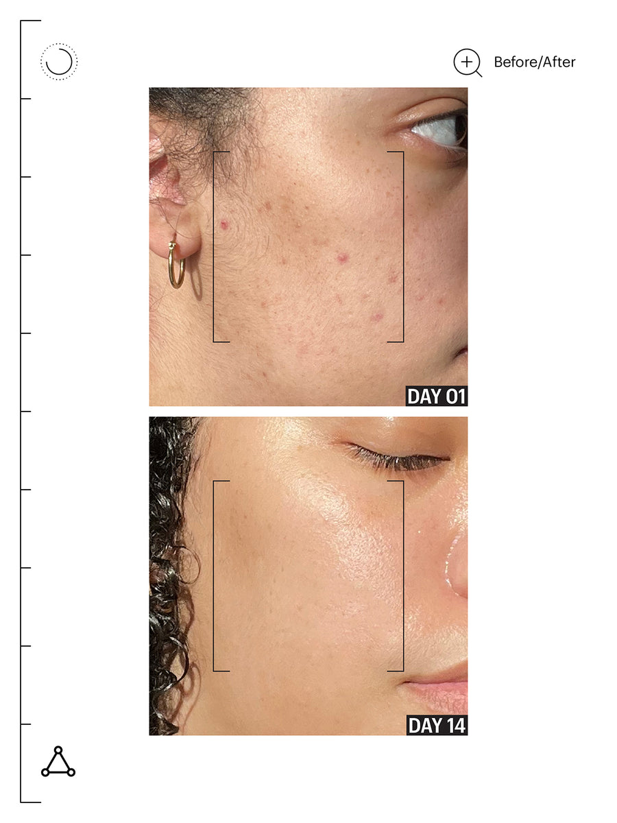 Molecular Barrier Recovery Cream Balm