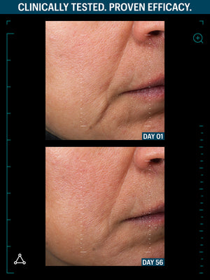 OVERNIGHT FIRMING DUO