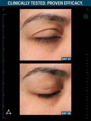 OVERNIGHT FIRMING DUO