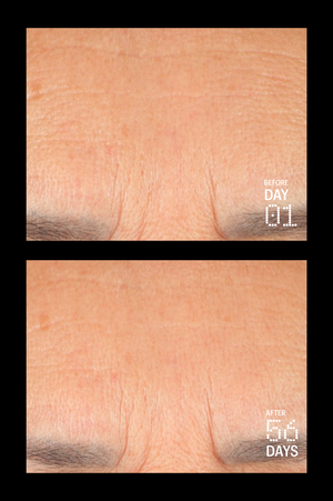 Peptides & Antioxidants Advanced Firming Daily Treatment