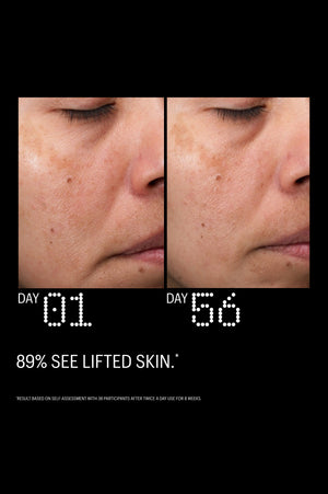 Multi Peptides & GF Advanced Lifting Serum, 15ml