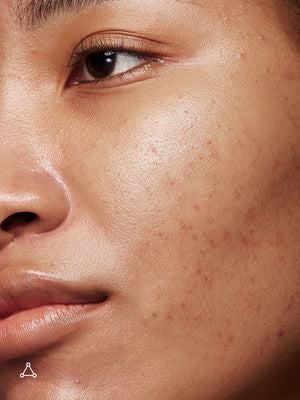 Deluxe Mandelic Pigmentation Corrector Night Serum, 8ml