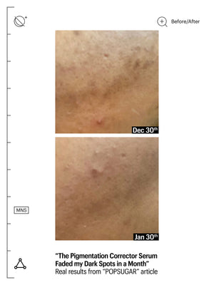 Deluxe Mandelic Pigmentation Corrector Night Serum, 8ml